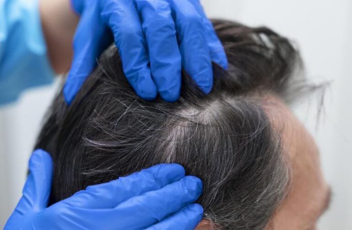 Dr Gary Roberts – Píldoras para el crecimiento del cabello: La solución avanzada para un cabello hermoso y saludable