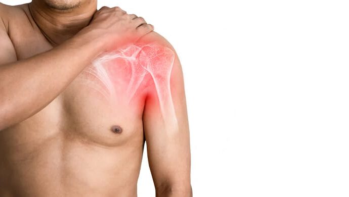 Artrocen Max: una solución para el dolor en las articulaciones y la columna vertebral